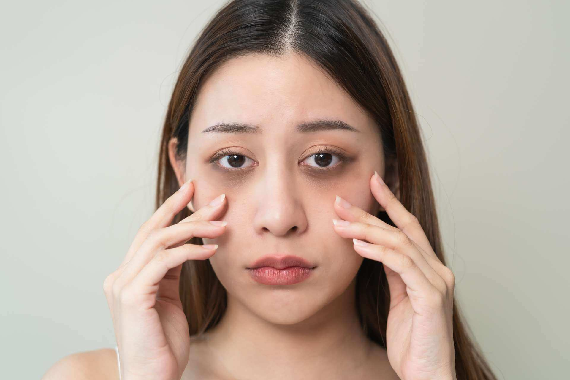 If you want to get rid of dark circles forever then know these 5 reasons why they happen 1