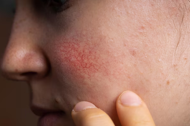 skin irritation problem know reason by