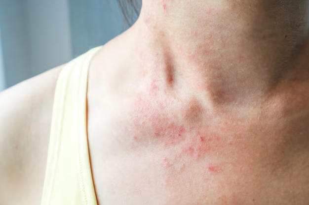 skin irritation problem know reason by