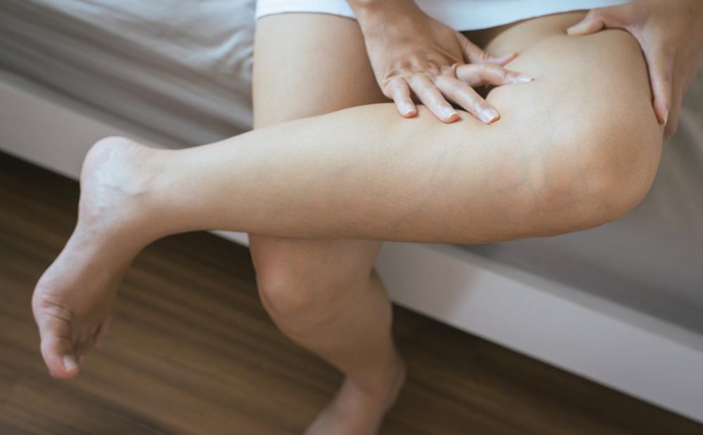 leg pain cramps and swelling symptoms of gangrene 1