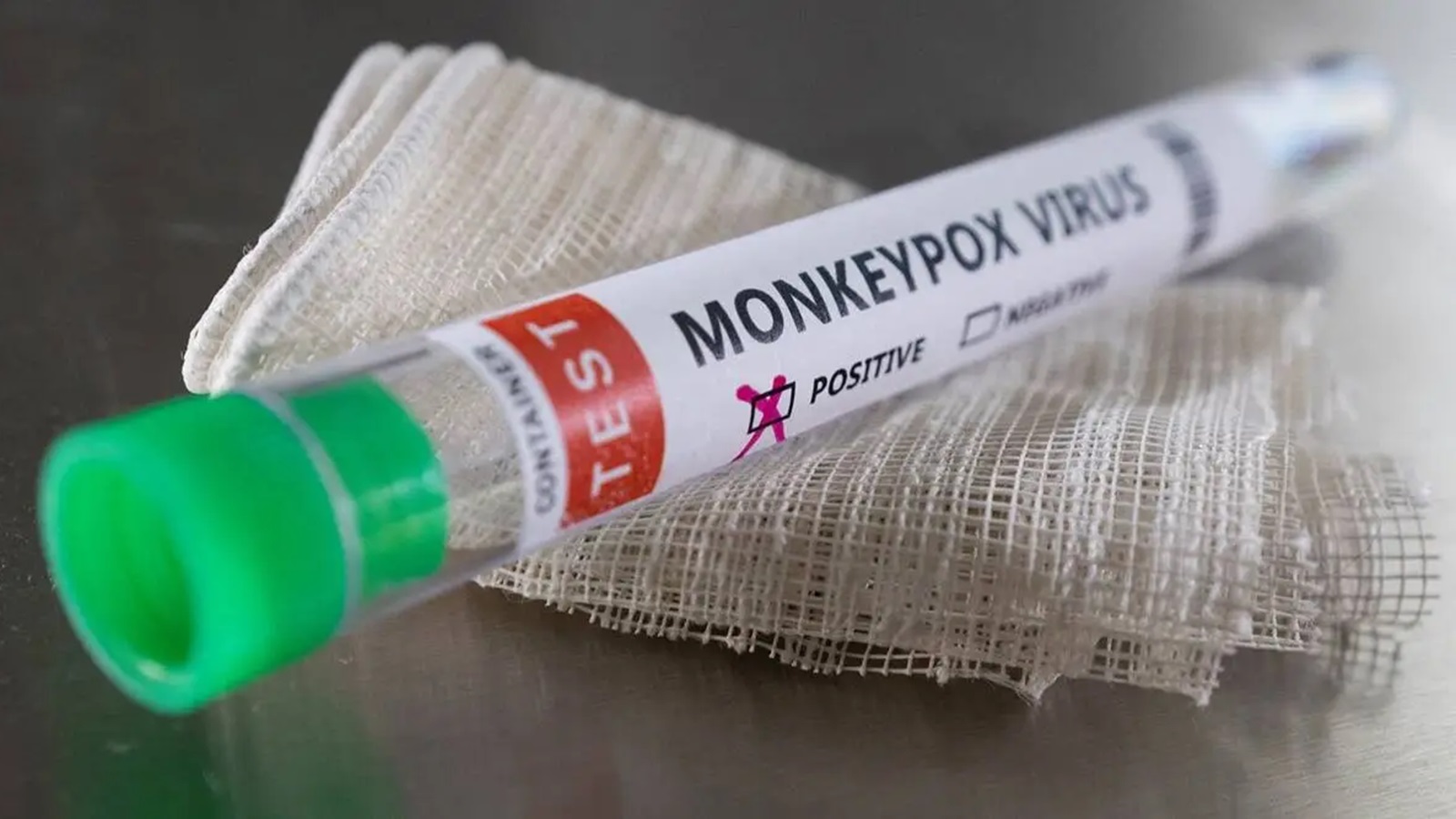 ncr mpox virus monkeypox spreading across the world center gov reviews situation jprime1