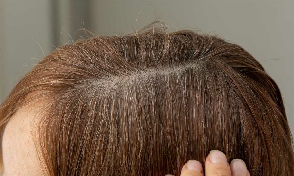 tips to hide grey hair instantly naturally at home without hair colour1