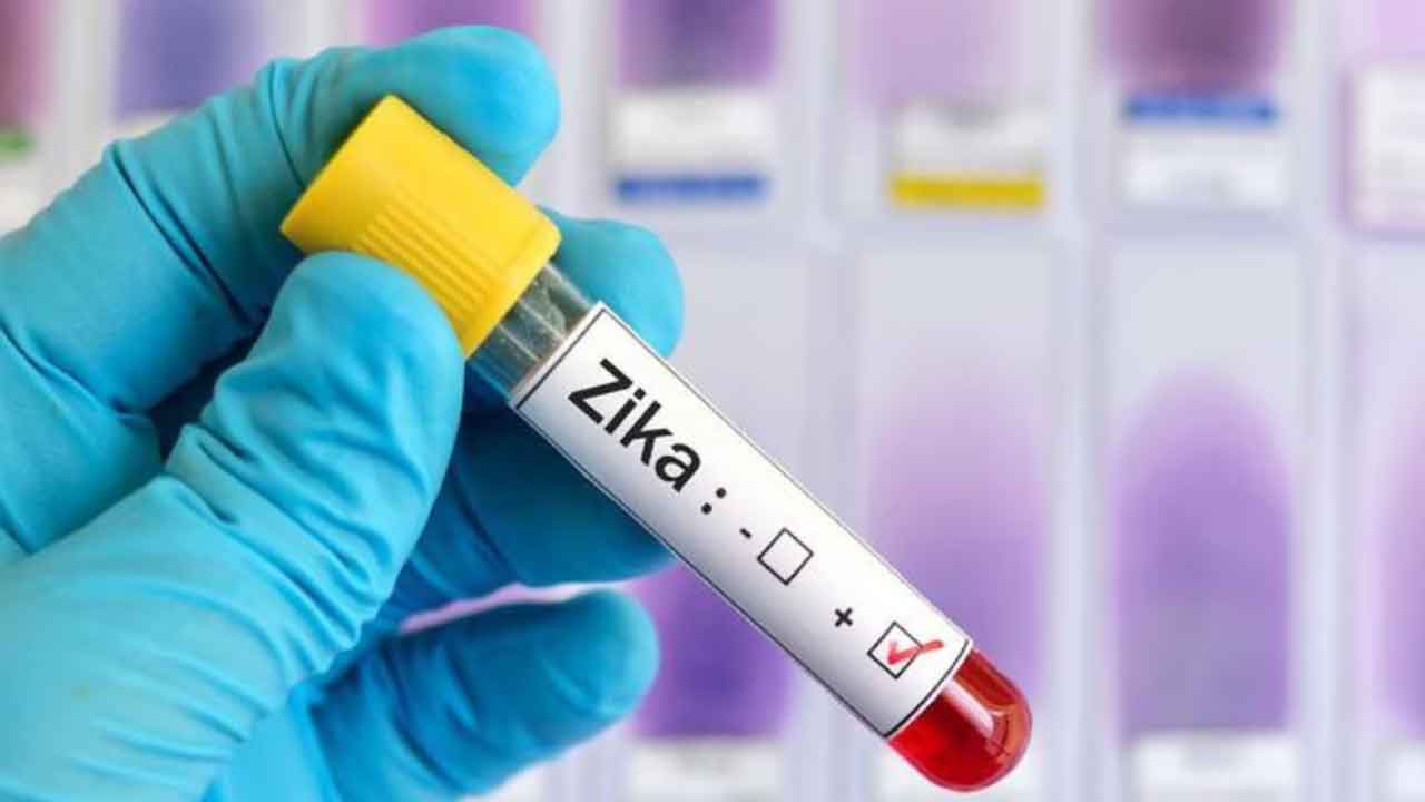 zika virus case detected in gujarat patient discharged after treatment1