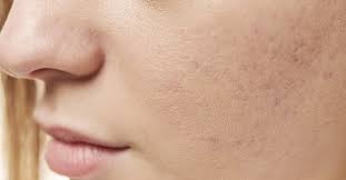 which vitamin deficiency causes dry skin