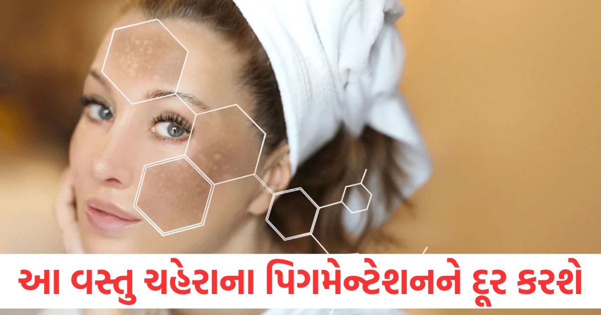 બે રૂપિયામાં મળતી આ વસ્તુ ચહેરાના પિગમેન્ટેશનને સરળતાથી દૂર કરશે how to remove pigmentation from face permanently naturally at home
