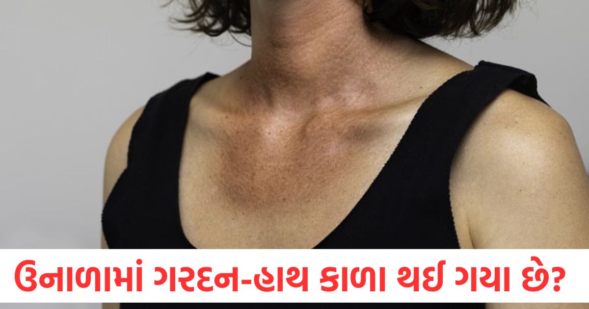 ઉનાળામાં ગરદન અને હાથ કાળા થઈ ગયા છે? 5 અસરકારક ઘરેલું ઉપચારથી ટેનિંગથી છુટકારો મેળવો tips and tricks summer tips how to remove tanning from neck and arms