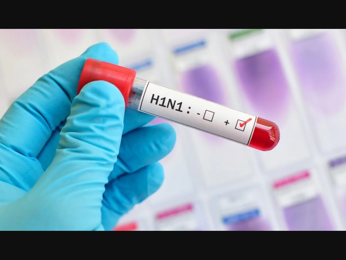 દિલ્હીમાં H1N1નો ઉછાળો: 1,777 કેસથી ચિંતા, શ્વાસમાં તકલીફ અને ઓક્સિજન ઘટે તો તાત્કાલિક સાવધાન GARVI GUJARAT 74